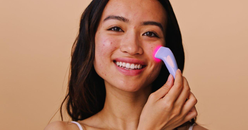 Bye Acne’s 3-minute treatment