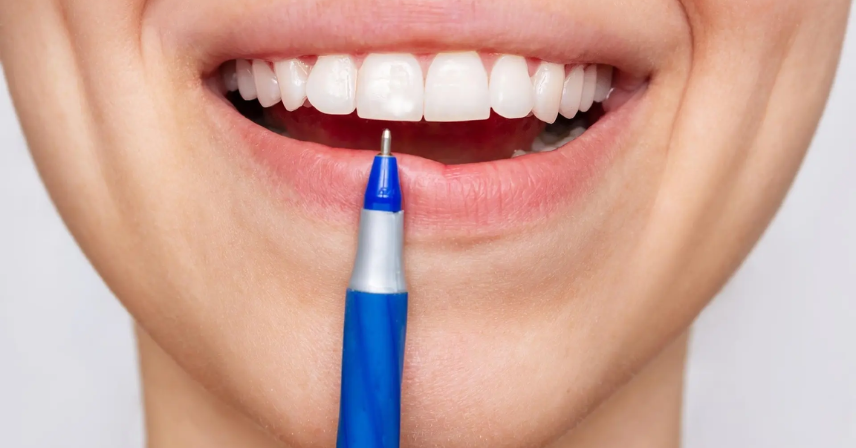 Teeth Whitening Pen